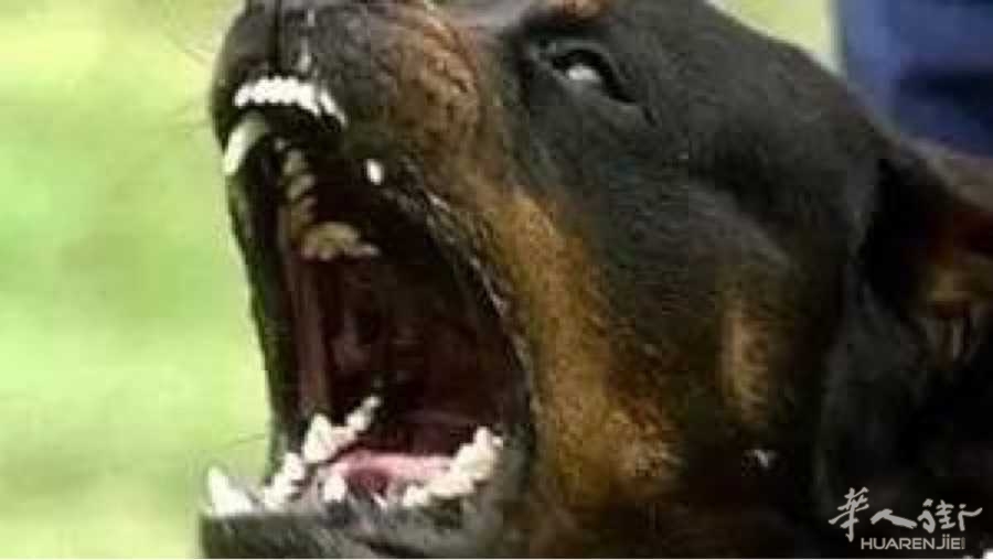 华人一岁小孩公园被狗咬,狗主人反而呵斥孩子