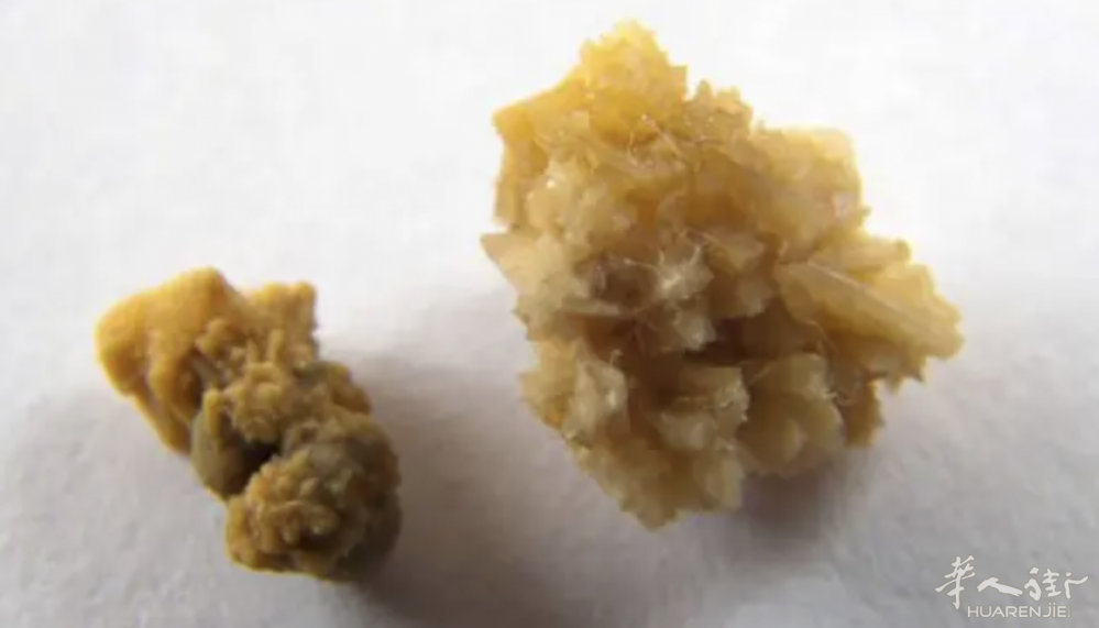 截屏2026-02-22 17.12.50.png