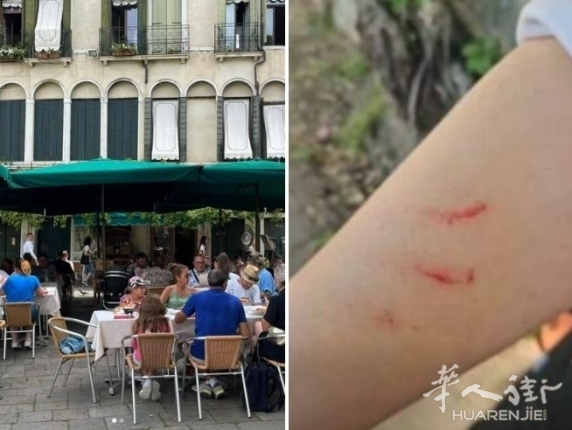 威尼斯扒手猖狂：华人老板娘保护客人反被抓伤胳膊