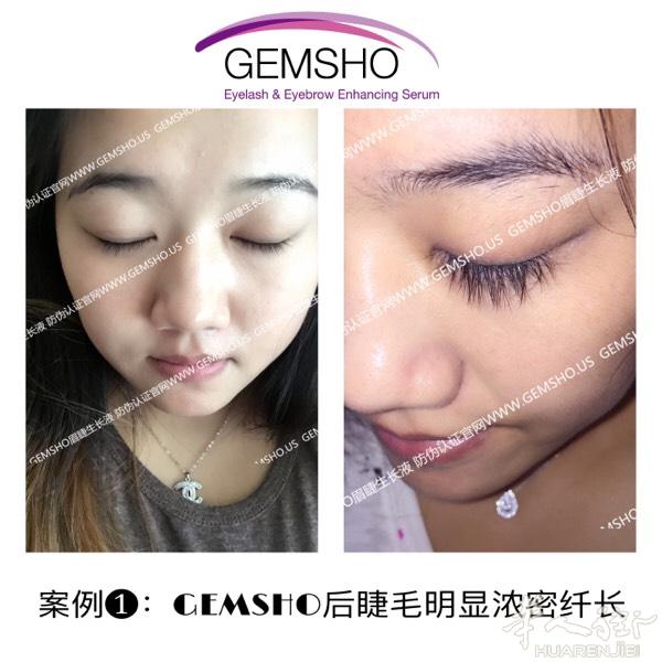 gemsho 生长液让你拥有自己的长睫毛
2瓶无效