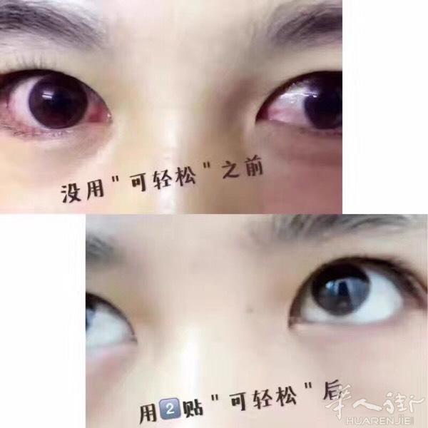 可轻松护眼贴是华北制药新品（世界500强企业家，6