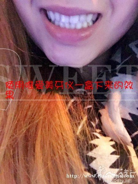 唯爱美牙仪，牙膜，现货，喜欢的微我