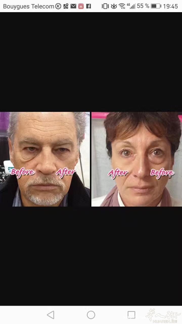 jeunesse 2分钟去眼袋