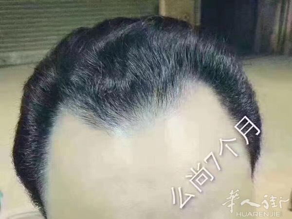 城招代理！想做微商或者想学微商可以加我！微信号: