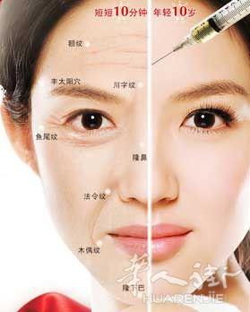 玻尿酸 瘦脸针 除皱针 中秋限时特价优惠活动中
