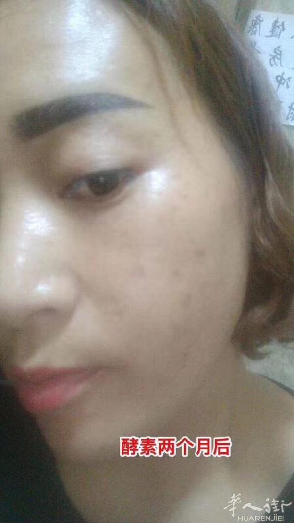 喝酵素两个月的变化👇👇
可见排毒的重要性😱😱