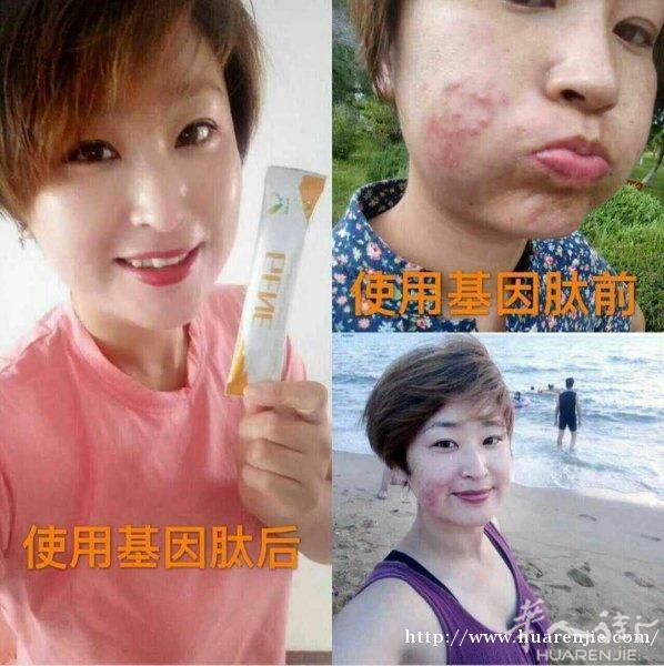 神奇的小分子肽