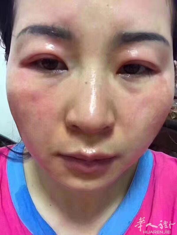 冉冉医生使用产品十个月的改变，看过全国各地有名的医
