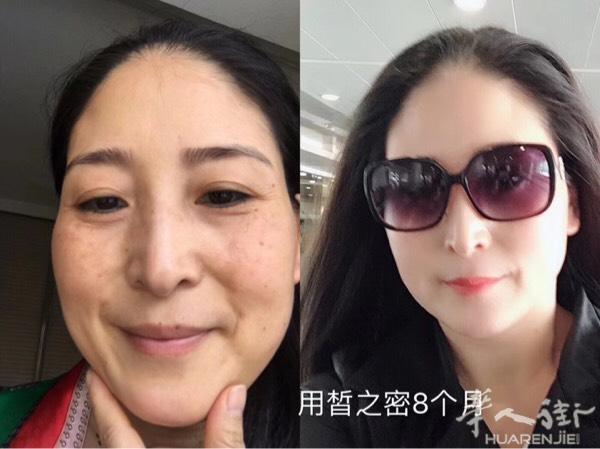 劲爆 劲爆 皙之密新推出优惠套餐：抢疯了[色][色