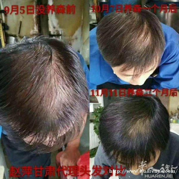 养森瘦瘦包全法热卖中