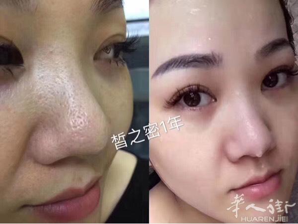 这是我遇到最多的朋友反馈… 但是我们理性的来看待
