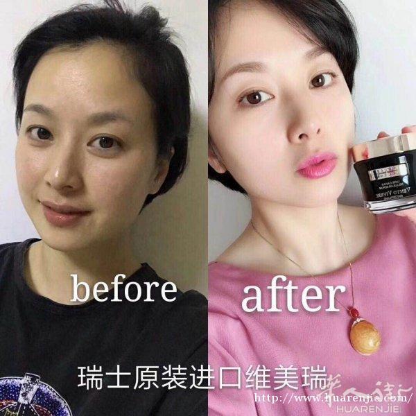 瑞士🇨🇭全球顶级抗衰老护肤领军品牌-维美瑞-火爆招代理➕零售
