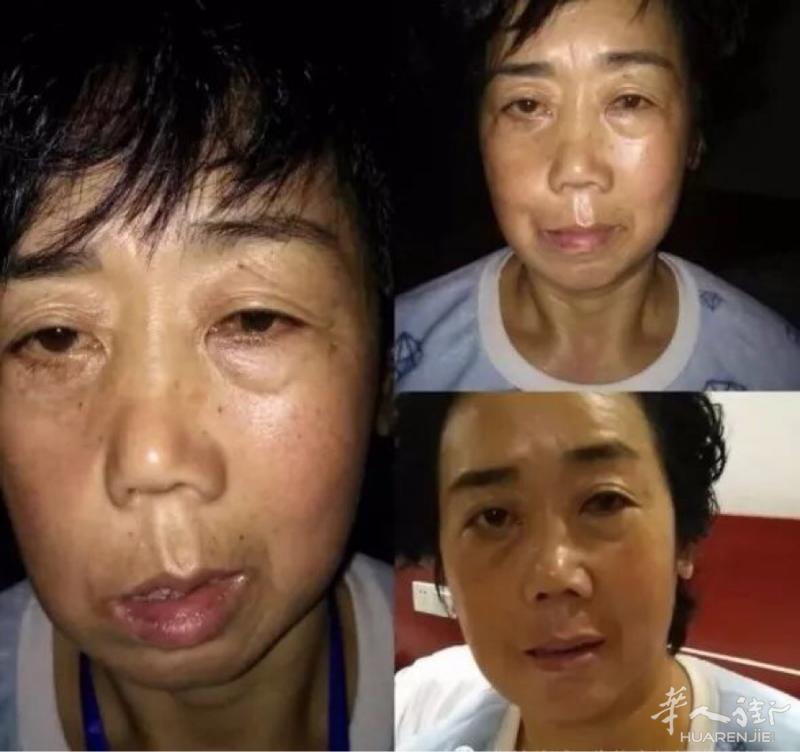 朋友我是高级理疗师 所有经络引起的疼痛 腰椎病肩周
