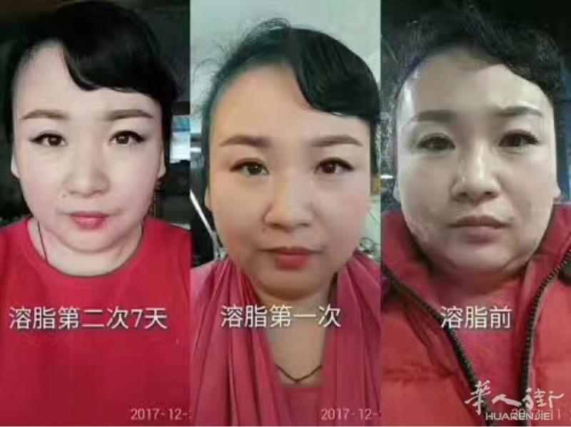 🎉活动大优惠‼️‼️

🎀只要第一次来体验奢美