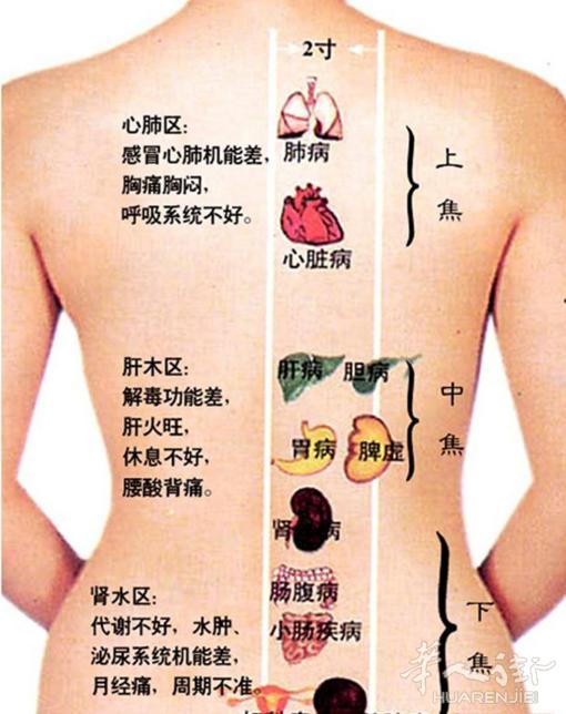 佛罗伦萨专业按摩刮痧推拿专业治疗颈椎病