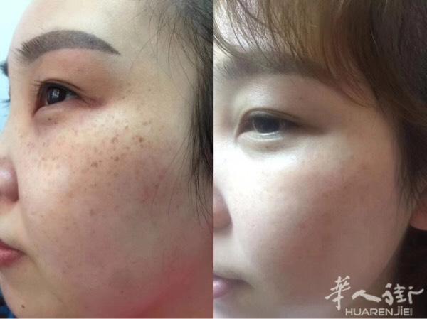 皙之密：淡斑反馈
分享经济就是你买到好的东西
你就