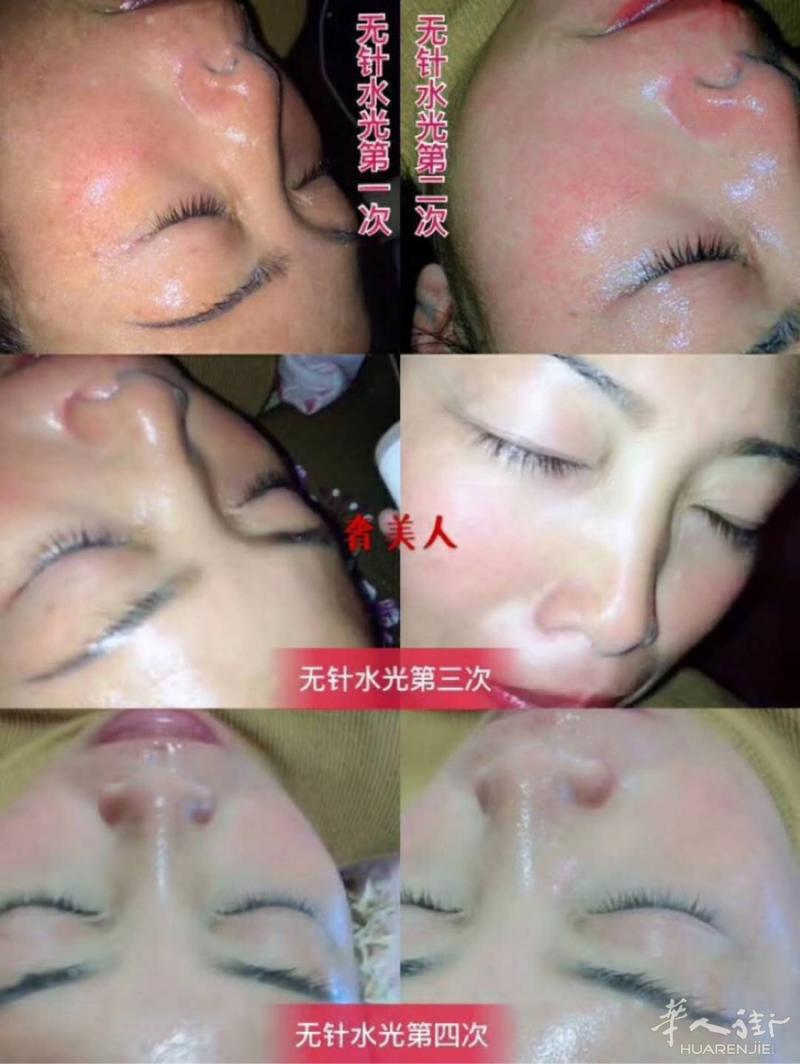 🌟
      为什么微整行业的医生都选择奢美人