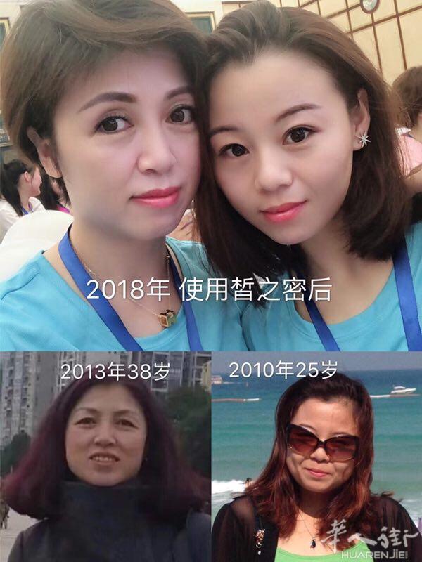 你没有用皙之密永远不知道自己会变美 变年轻成 怎么