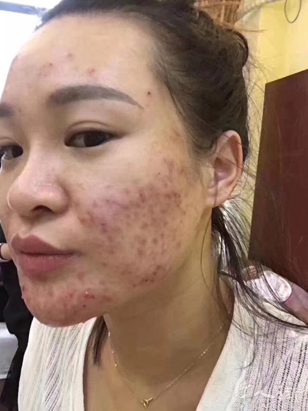 皙之密 受益者不断：越来越多的女人开始认知皙之密的