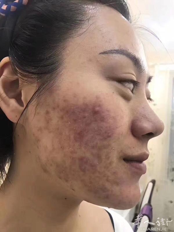 如果你现在用的保养品，还是觉得对自己的皮肤不满意，