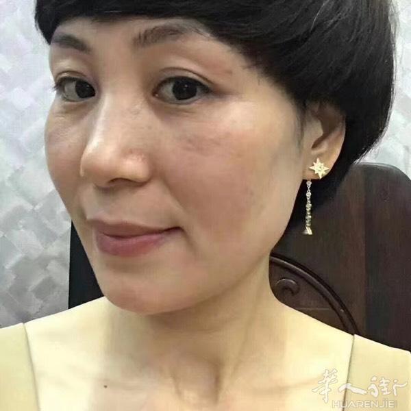 皙之密好评数不胜数：
每个顾客都是我们产品的代言人