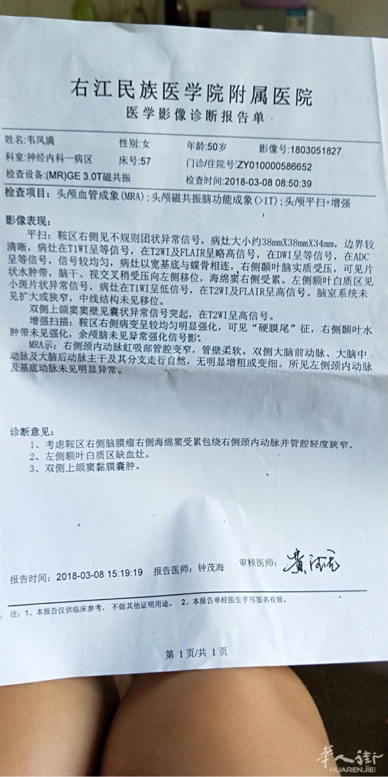 有没有治疗脑补肿瘤的特效药或者延缓肿瘤变大的药。