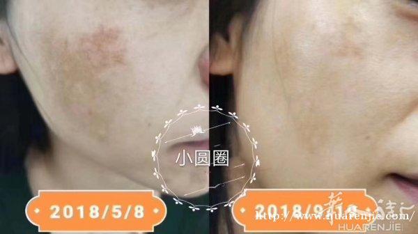 胡庆余堂膏