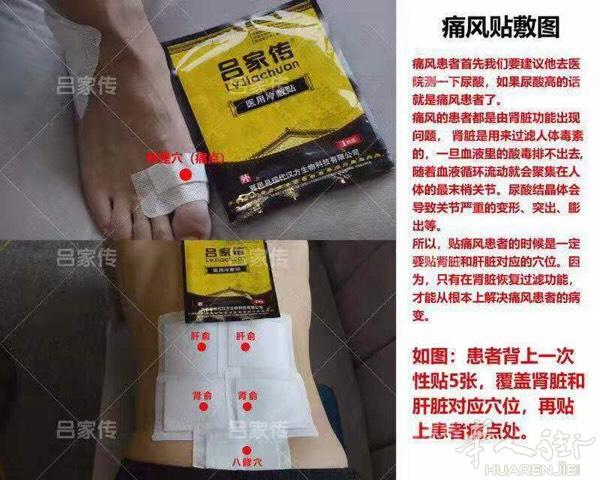 跌打损伤，腰间盘突出，风湿关节炎，颈椎病患者，吕家