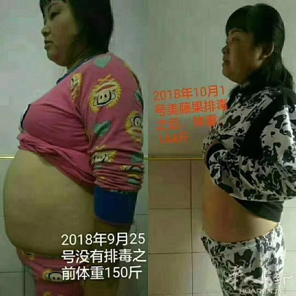 全新水果酵素粉可以快速清除肠内囤积多年的宿便💩垃