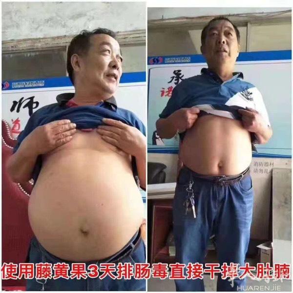 安全可靠！三天见效，一盒搞定，物美价廉！美国FDA