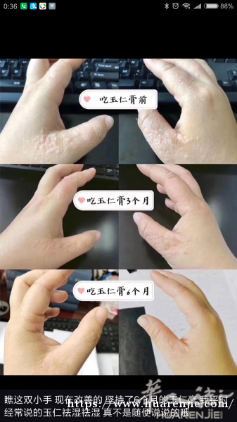 胡庆余堂食品养生膏(详细咨询加微信：chenshaoyan313181