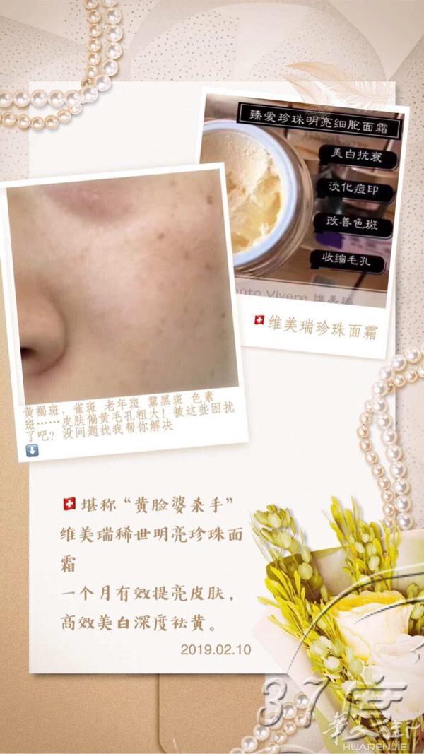 招代理！！瑞士高端护肤品vento viv