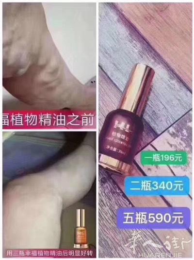 ✅顾客的静脉曲张用幸福精油疏通后的反馈👇👇