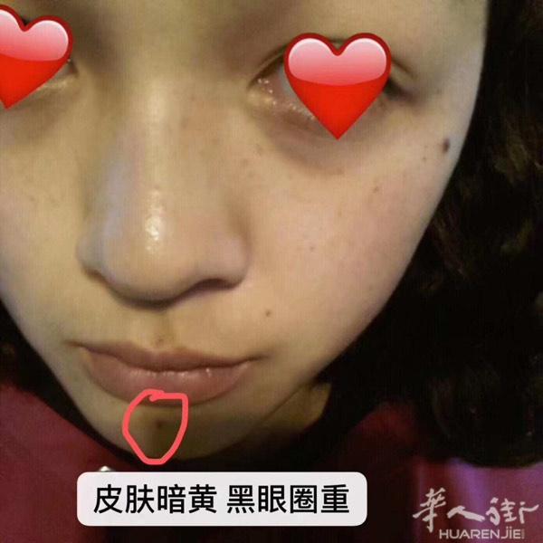 ：Vimi抗糖胶原蛋白饮 别老‎说​气‎色​和皮肤