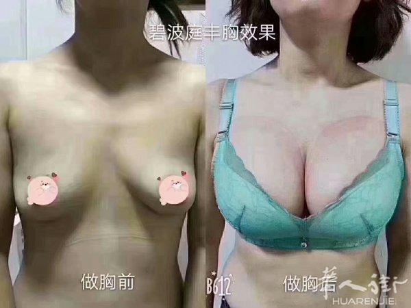专业催乳师调理身体
