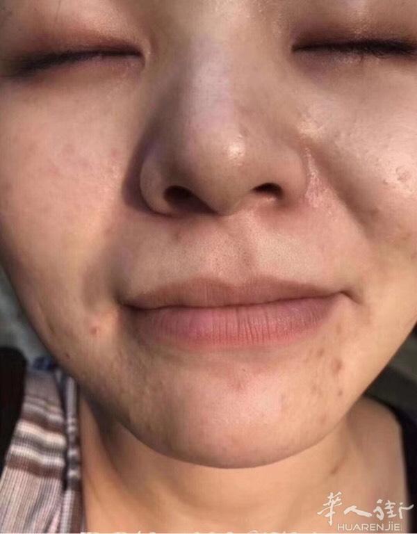 想要皮肤白皙光滑细腻透亮吗？
皙之密可以帮你达到无