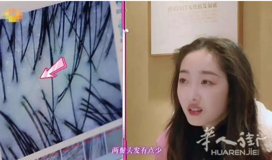 免费看脸|气质女主播如何变成上镜可爱性感小野鹿？