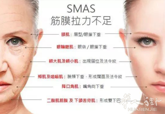 还在纠结是热玛吉or超声刀？？现在流行这样做……