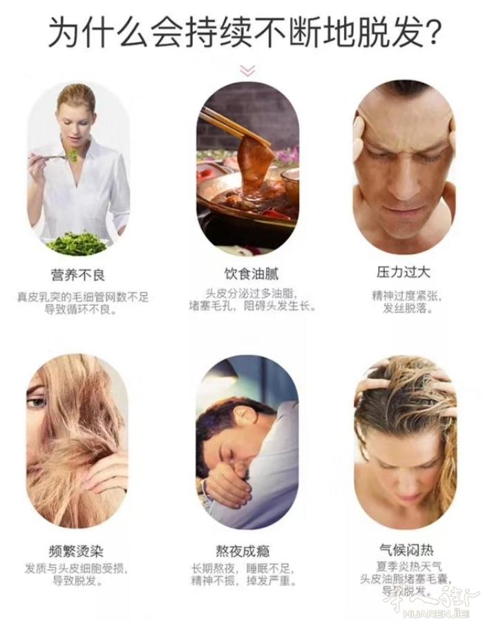 脱发者的福音产品，德国Fitline生发套装 NTC技术从内到外的科学性养护头发