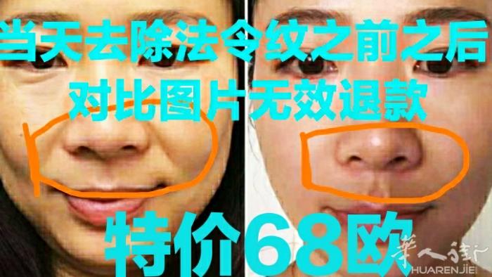 😄[OK]迎春节[玫瑰]美容优惠年卡(仅2折)套餐(原价4680欧，优惠年卡[
