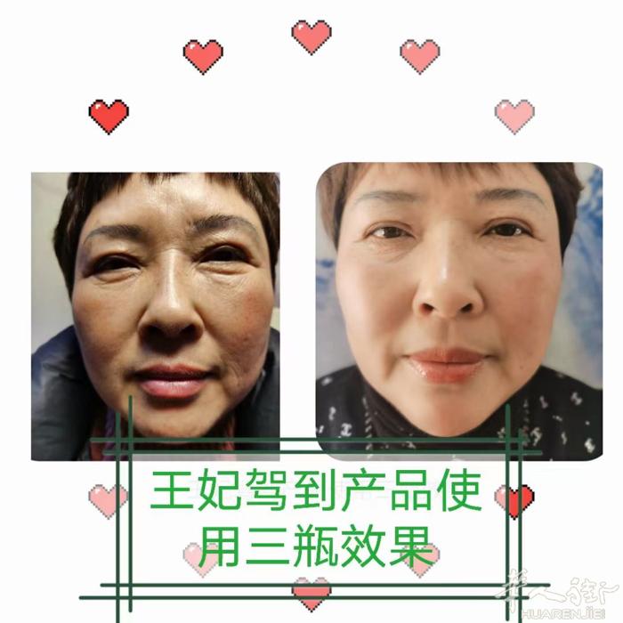 点开看看^_^ 这个效果也太给力了‼️‼️‼️ 我们家客户使用王妃3瓶的效果对比