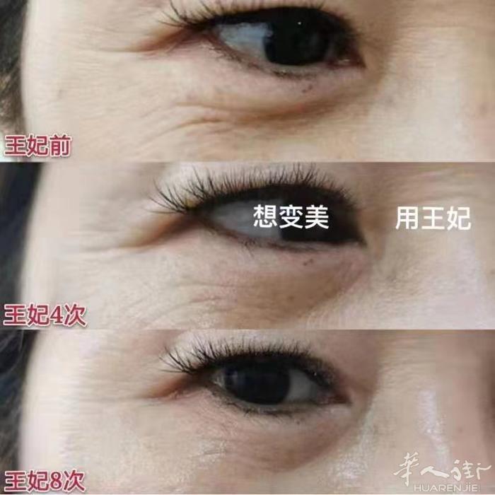 想变美，用王妃 让你看得到，摸得到 感受得到‼️‼️‼️ ➕微信详聊：zxj16