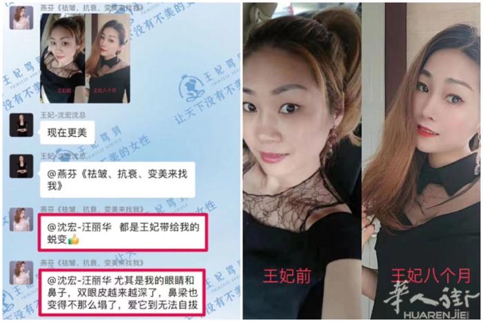 年龄从来不是追求美丽的障碍 王妃给你带来的变化是眼见为实的 你，还在等什么？ 加