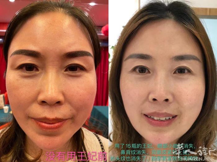 贵族的品质‼️ 平民的价格‼️ 惊人的效果‼️ 看看我们吴素芹吴总使用王妃15瓶
