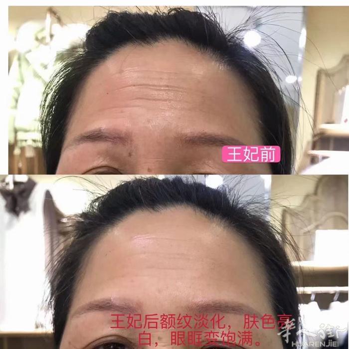 想要不显老，抗皱要做好！ 王妃驾到抗皱能量精华喷雾 抵抗皱纹侵袭 捍卫你的年轻肌