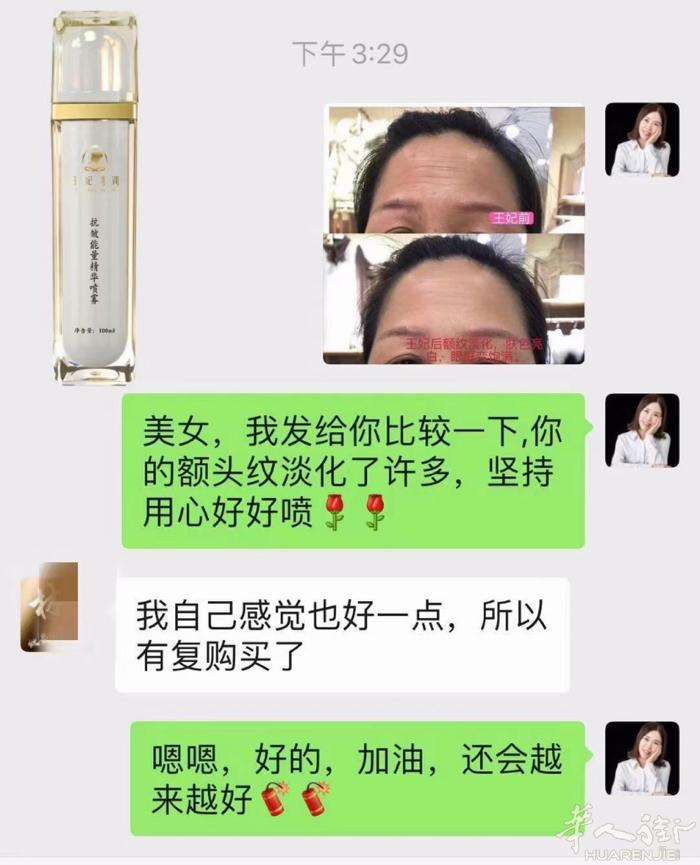 [爱心]王妃驾到抬头纹淡化反馈！效果好不好，一定是用在脸上实打实看的到的。王妃不