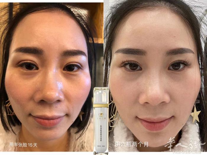 用效果征服你[耶] 用口碑告诉你[耶] 美，总是令人心动，因为你同样值得拥有[抱
