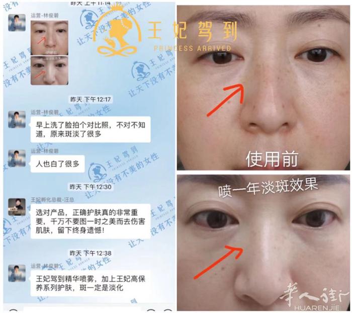 产品效果怎么样？  用实打实的效果告诉你‼️  变美逆龄，就选王妃[强][强]
