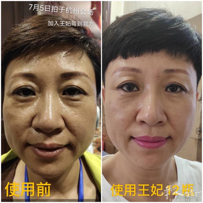 因为一次相信，用上王妃  使用12瓶王妃，轻松实现逆龄5岁[鼓掌][鼓掌][鼓掌