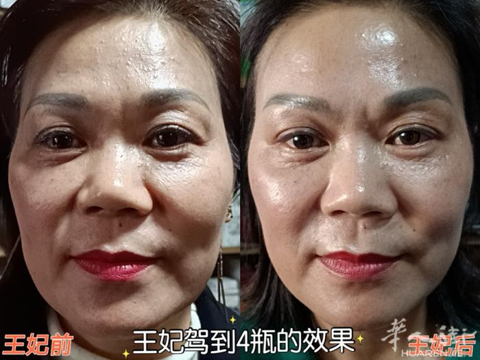 [爱心]王妃驾到我们桐庐的洪姐用了4瓶的真实效果，脸部紧致提升，苹果肌也上提法饱